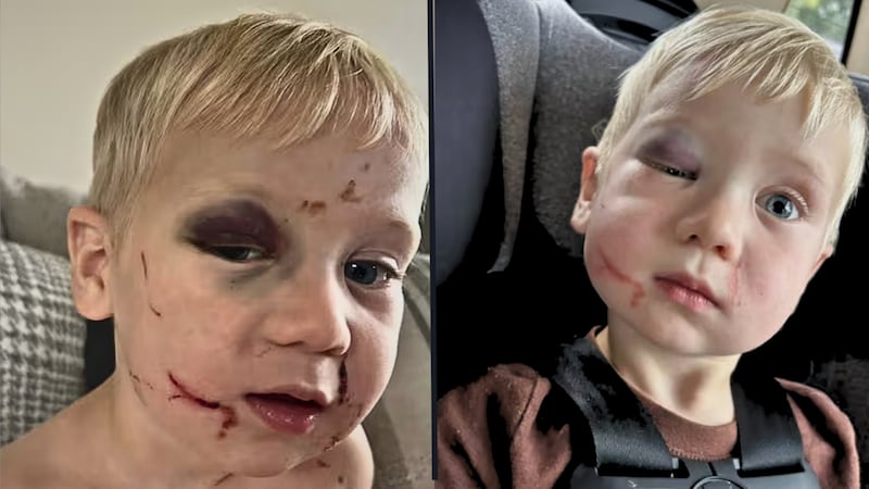 The child's family posted these photos of the boy on social media. WCTV obtained permission...