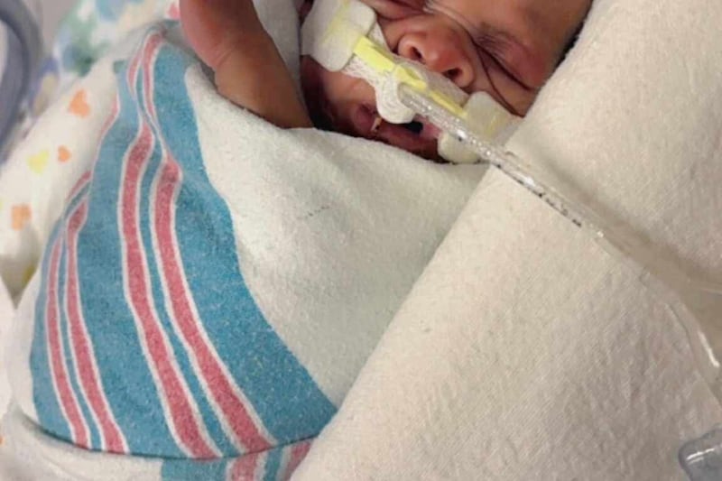 Loyal Milani Barthell was born at 23 weeks on Dec. 30, 2024, about 4 months before her due date.