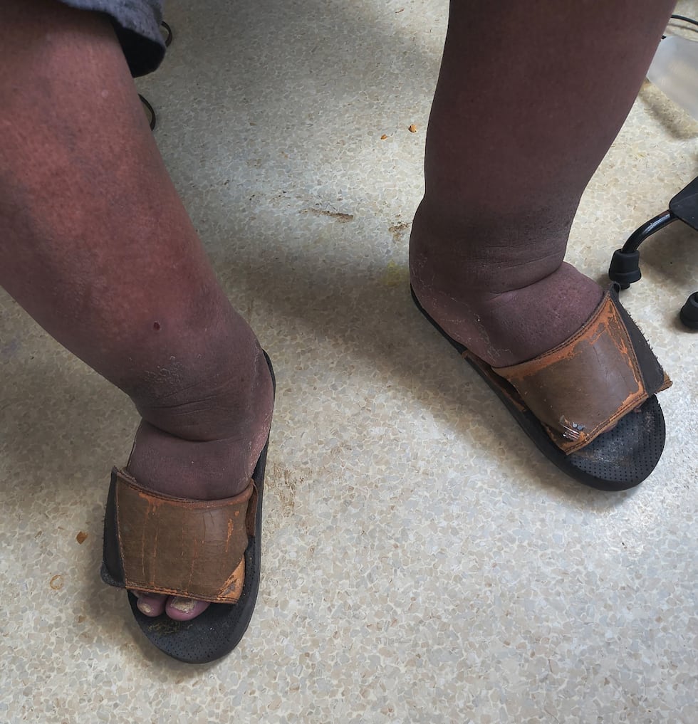 A family member noted that physical therapy orders, including specialized blue leg supports...