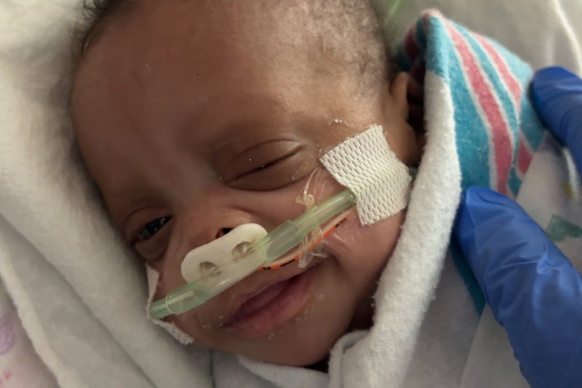 preloaded gallery image