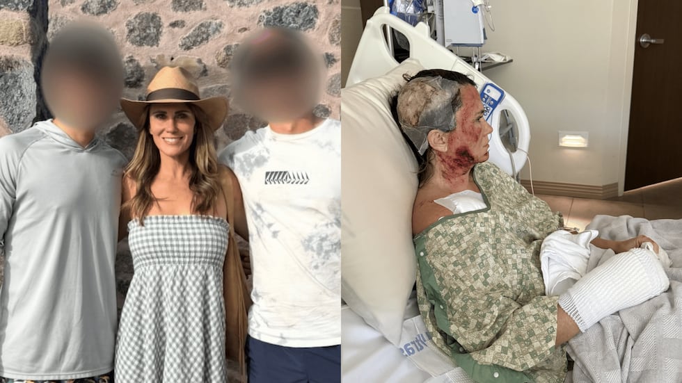 Photos of the victim before and after an acid attack in Forsyth Park