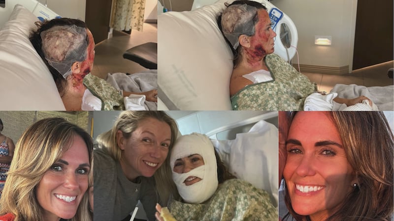Woman suffers third-degree burns in Forsyth Park acid attack; Community concerned