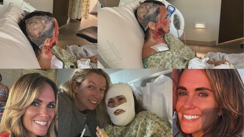 Woman suffers third-degree burns in Forsyth Park acid attack; Community concerned