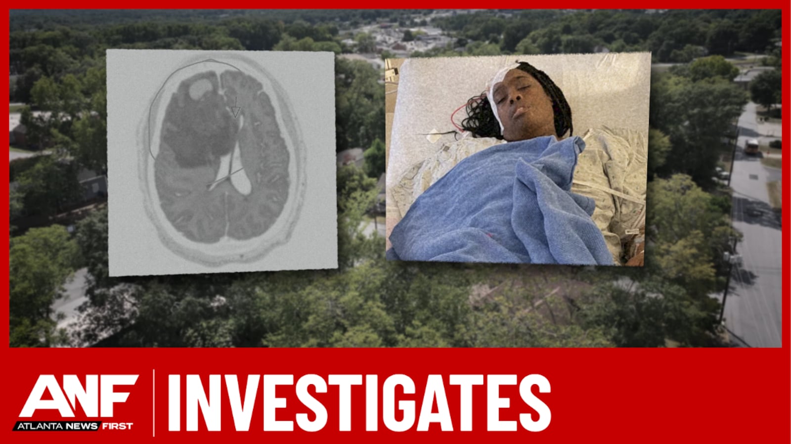 Kimberly Knight is shown with an image of her brain scan. Her husband believes his wife’s rare...