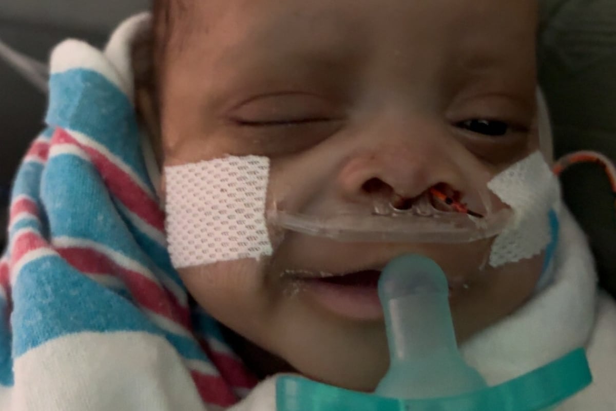 preloaded gallery image