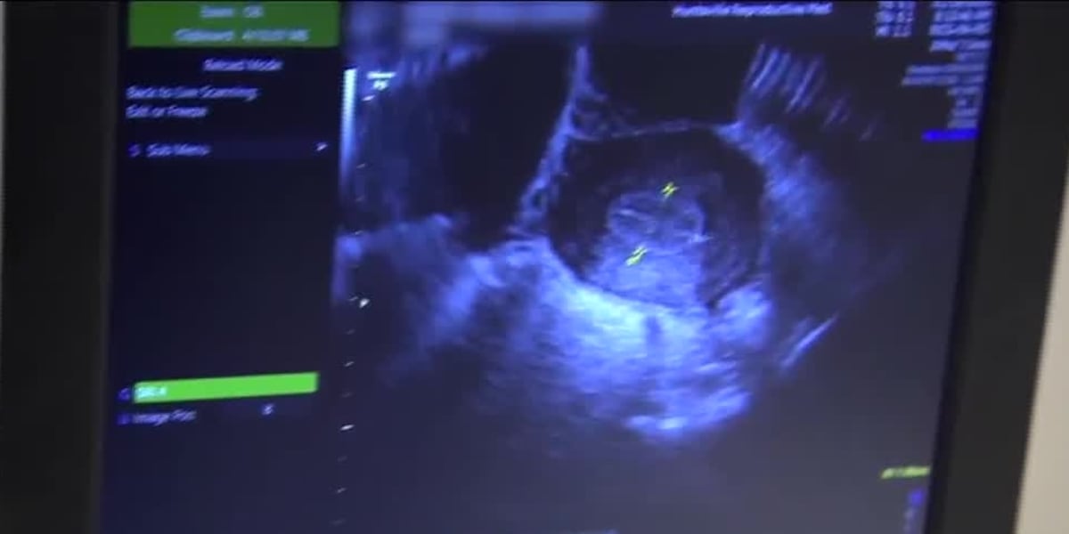 South Georgia Faces Women's Health Crisis: Local OB/GYN Raises Concerns, Hospital System Responds