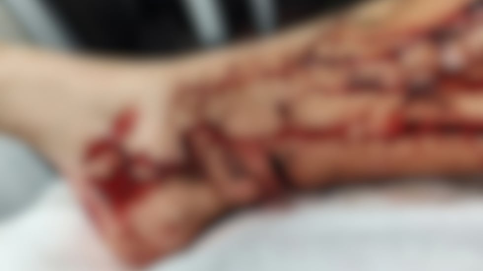 An 11-year-old boy in Atkinson County underwent several hours of surgery after reportedly...
