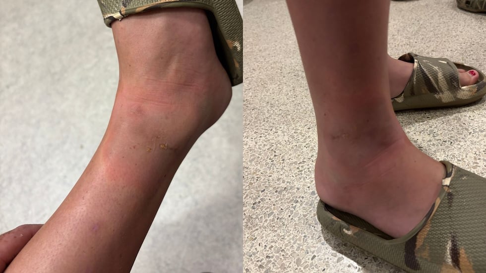 Father describes fireworks malfunction that injured his daughter at Crisp County show