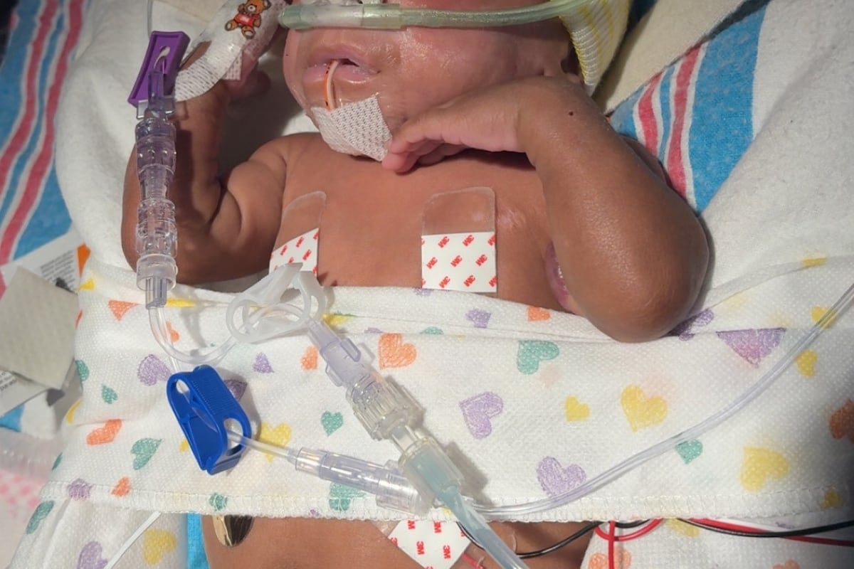 preloaded gallery image