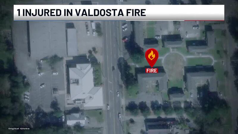 One person was injured during an apartment fire in Valdosta on Thursday afternoon.