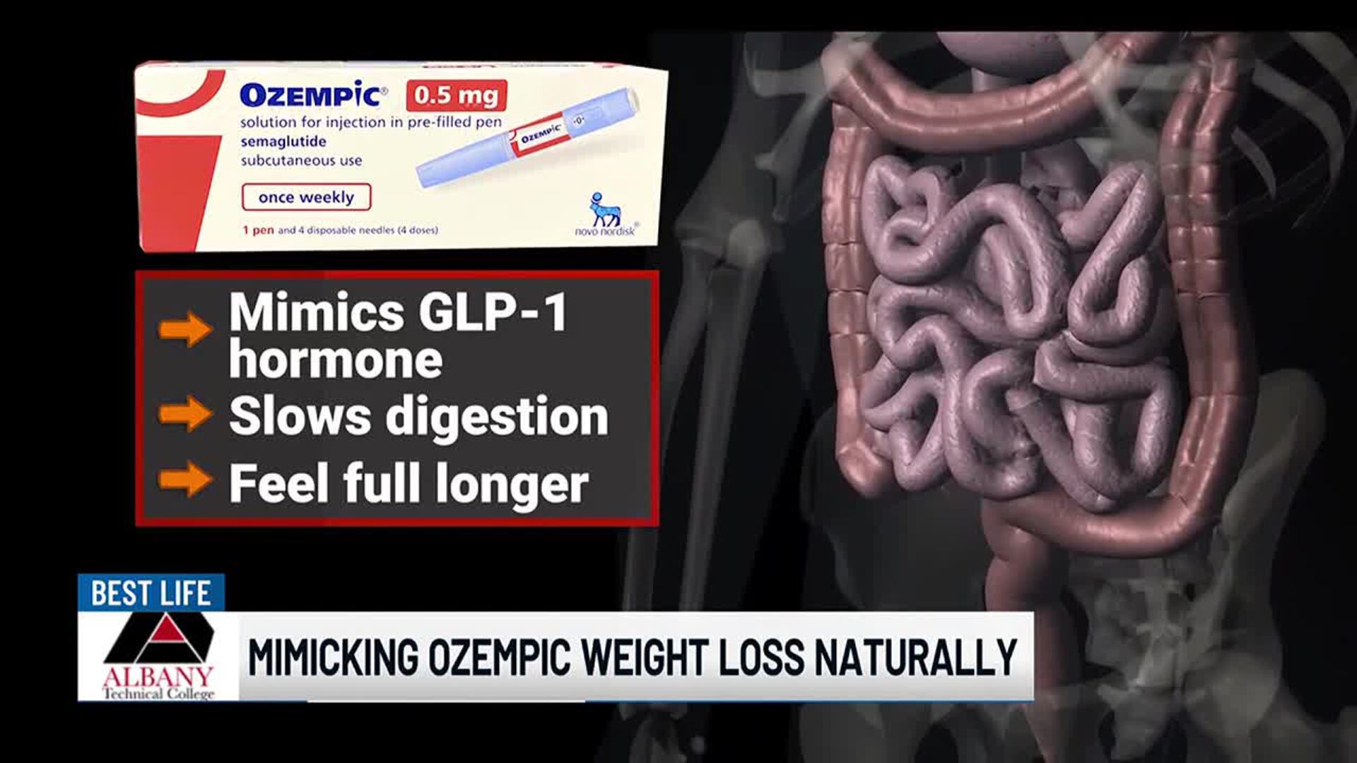 tirzepatide vs semaglutide for weight loss reddit Comparing the Big 3, Semaglutide, Tirzepatide and Retatrutide : r/Mounjaro tirzepatide vs semaglutide for weight loss reddit Comparing the Big 3, Semaglutide, Tirzepatide and Retatrutide : r/Mounjaro