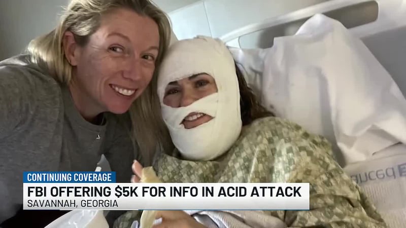 FBI offering $5,000 reward for information on Forsyth Park acid attack